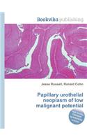 Papillary Urothelial Neoplasm of Low Malignant Potential