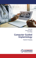 Computer Guided Implantology