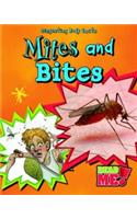 Mites and Bites: (Disgusting Body Facts)