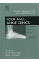 Complex Salvage of Ankle and Hindfoot Deformity