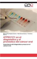 ATP6V1C1 en el diagnóstico y el pronóstico del cáncer oral