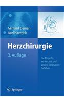 Herzchirurgie