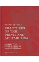 Fractures of the Pelvis and Acetabulum