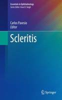 Scleritis