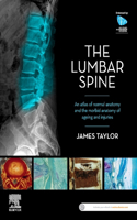 Lumbar Spine