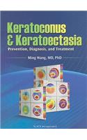 Keratoconus and Keratoectasia