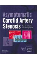 Asymptomatic Carotid Artery Stenosis