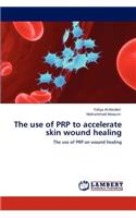use of PRP to accelerate skin wound healing