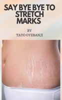 Say bye bye to stretch marks