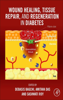 Wound Healing, Tissue Repair, and Regeneration in Diabetes