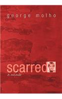 Scarred: A Memoir