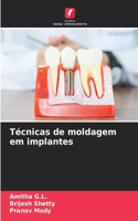 Técnicas de moldagem em implantes