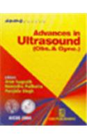 Advances in Ultrasound