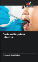 Carie nella prima infanzia