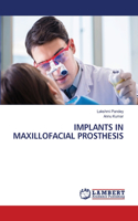 Implants in Maxillofacial Prosthesis
