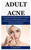 Adult Acne: The Complete And Definitive Guide On Everything You Need To Know About Adult Acne, Causes, Treatment And How To Completely Get Rid Of It For A Beaut