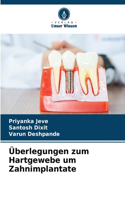 Überlegungen zum Hartgewebe um Zahnimplantate