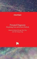 Prenatal Diagnosis