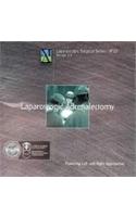 Laparoscopic Adrenalectomy