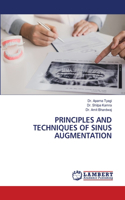 Principles and Techniques of Sinus Augmentation