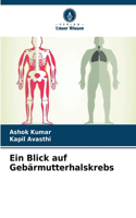 Blick auf Gebärmutterhalskrebs