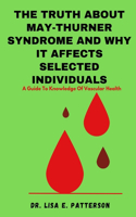 Truth About May-Thurner Syndrome And Why It Affects Selected Individuals