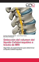 Detección del volumen del líquido Cefalorraquídeo a través de MRI