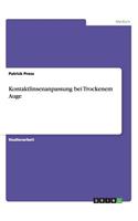 Kontaktlinsenanpassung bei Trockenem Auge