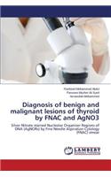 Diagnosis of benign and malignant lesions of thyroid by FNAC and AgNO3