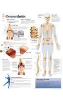Osteoarthritis Paper Poster