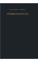 Verbrennungen