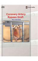 Coronary Artery Bypass Graft