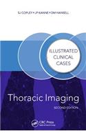 Thoracic Imaging