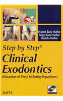 Clinical Exodontics
