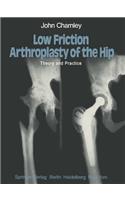 Low Friction Arthroplasty of the Hip