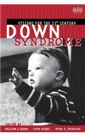 Down Syndrome