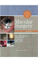 Macular Surgery