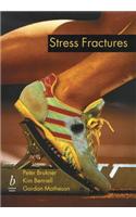 Stress Fractures