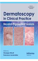 Dermatoscopy in Clinical Practice
