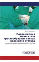 Povrezhdeniya meniskov i krestoobraznykh svyazok kolennogo sustava