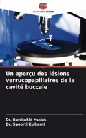 aperçu des lésions verrucopapillaires de la cavité buccale