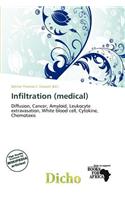 Infiltration (Medical)