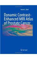 Dynamic Contrast-Enhanced MRI Atlas of Prostate Cancer