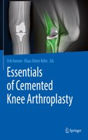 Essentials of Cemented Knee Arthroplasty