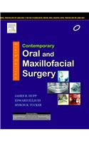 Contemporary Oral and Maxillofacial Surgery, 6e