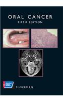 Oral Cancer