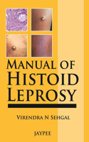 Manual of Histoid Leprosy