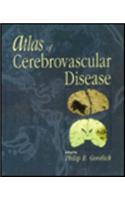 Atlas of Cerebrovascular Disease
