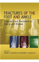 Fractures of the Foot and Ankle