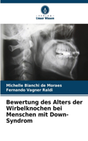 Bewertung des Alters der Wirbelknochen bei Menschen mit Down-Syndrom